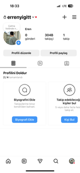 304 K INSTAGRAM HESABI
